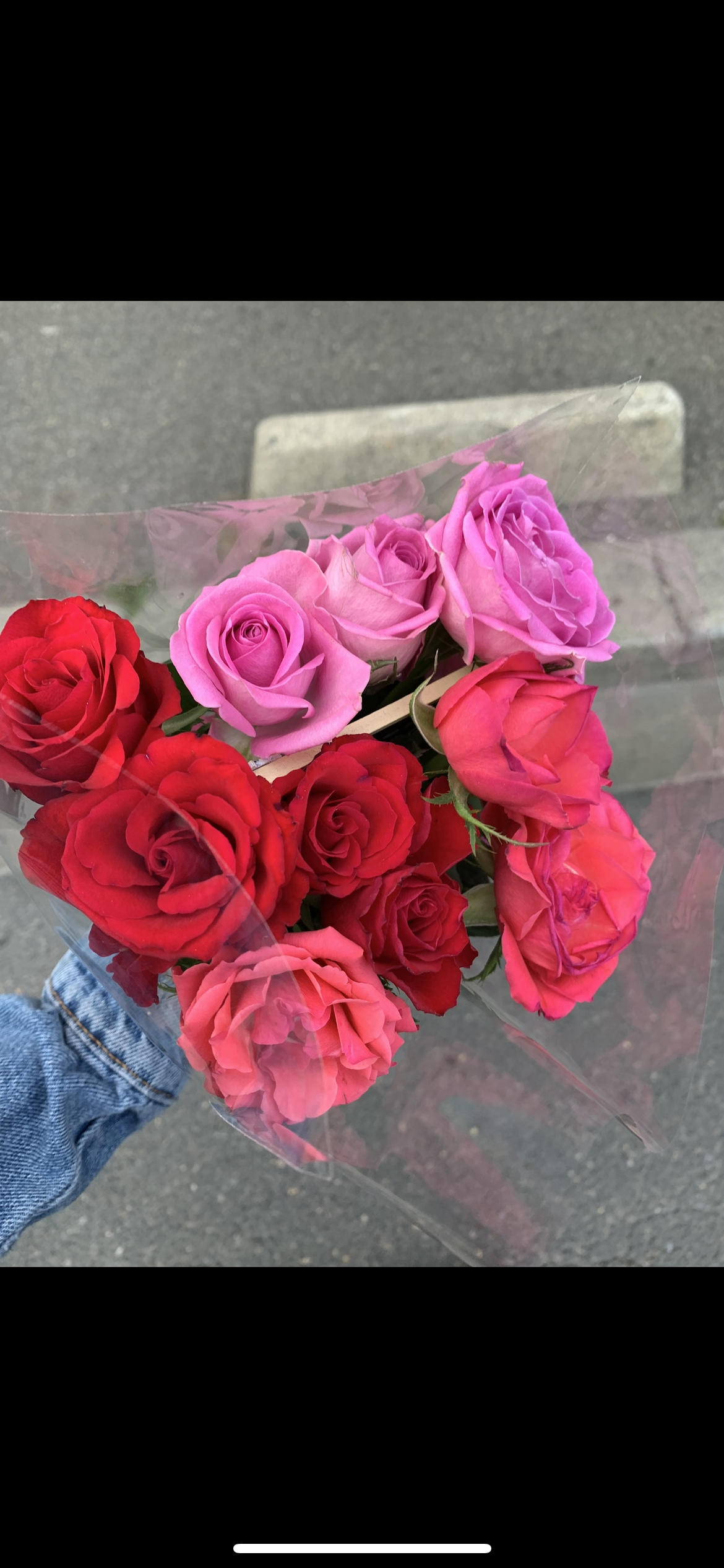 Embracing New Beginnings: Dating and Hair Loss